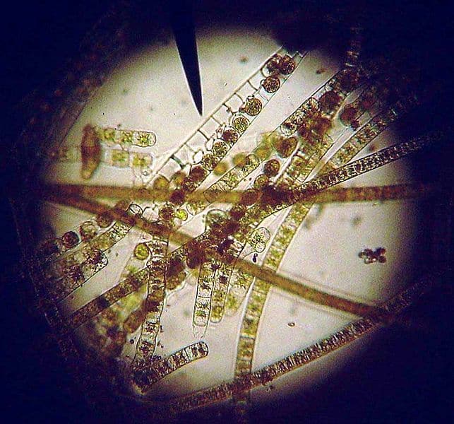 Algae Under Microscope - Treating Root Rot with Hydrogen Peroxide DWC